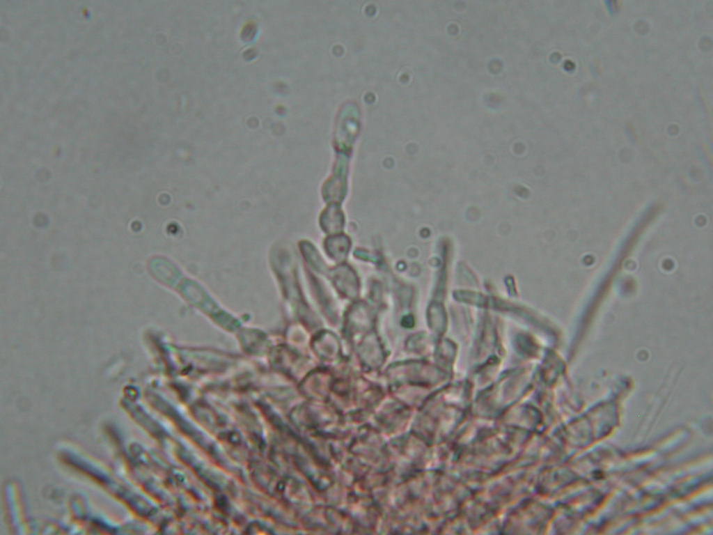 Sconosciuto (cfr. Ascocoryne sp.)
